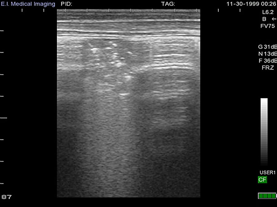 Thoracic Ultrasound in Calves